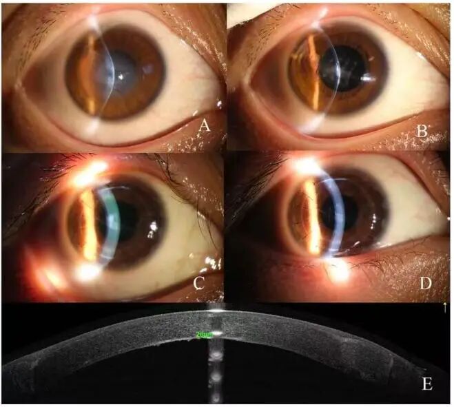 d8cb61b4af53cdf5c74642f8f9779d18.jpg d8cb61b4af53cdf5c74642f8f9779d18.jpg