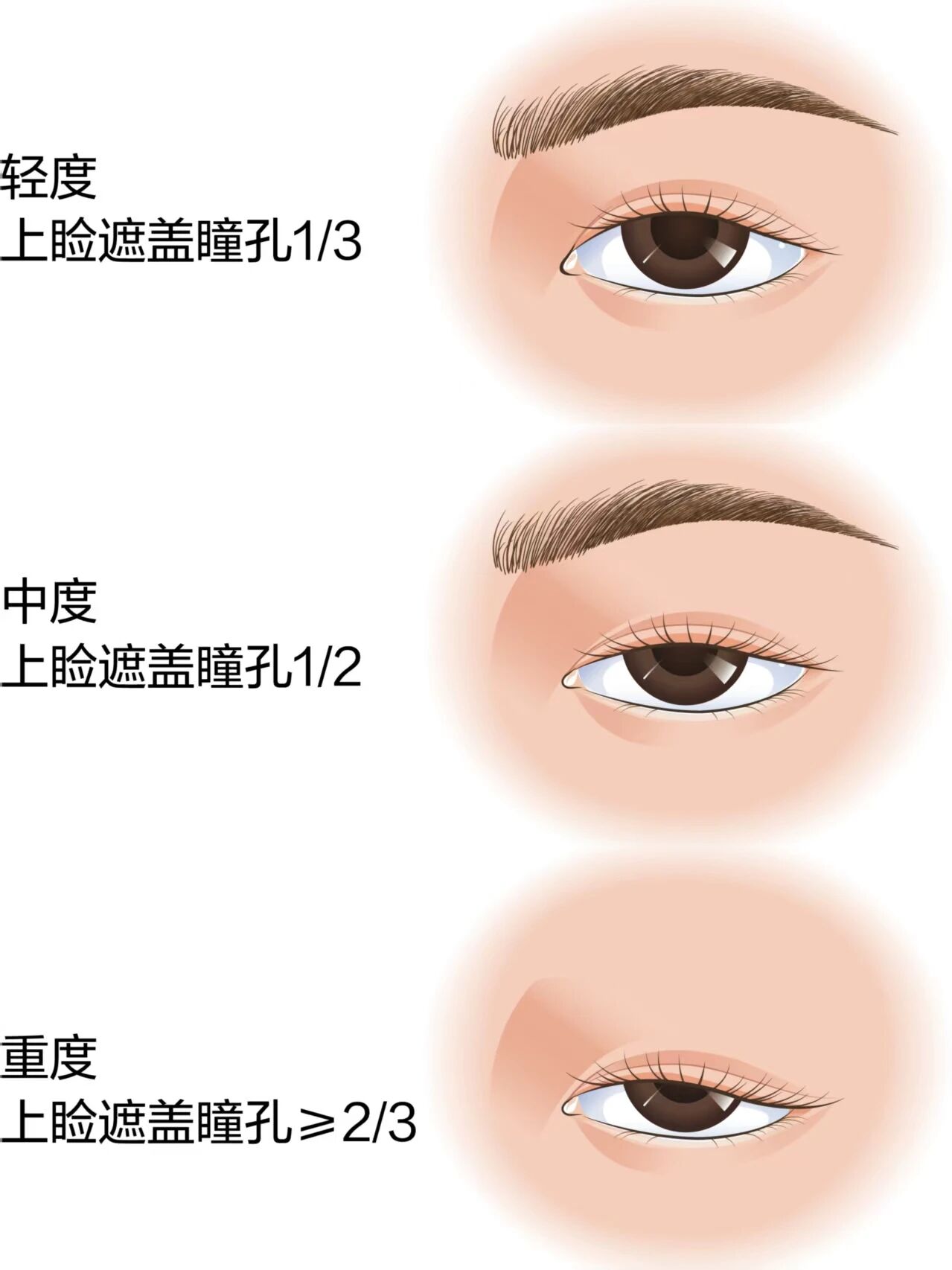 cb75f4843ceffacef861231cf98e3008.jpg