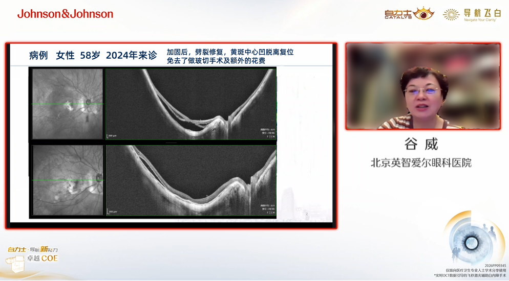 f65a57ab0ddfc24970ec2bdd7a2bc3e1.png